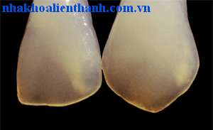 01092627_mau20rang201