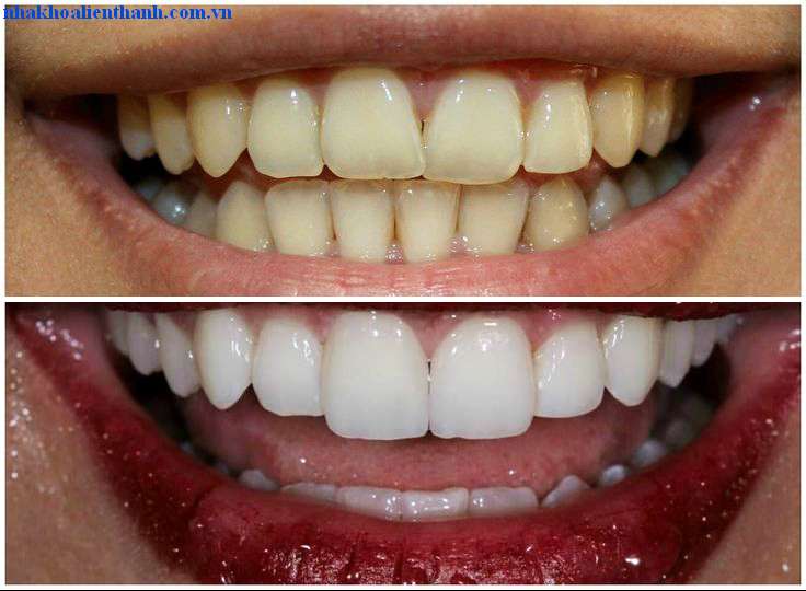 Khách hàng đã trải nghiệm sứ VITA