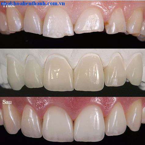 Khách hàng đã trải nghiệm sứ VITA