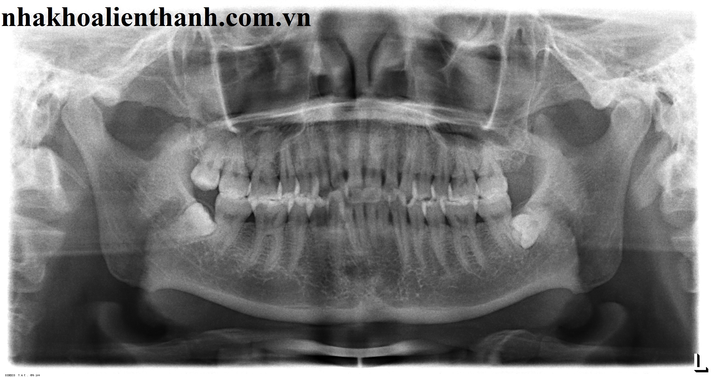 19221917_nguyen20minh20dac201