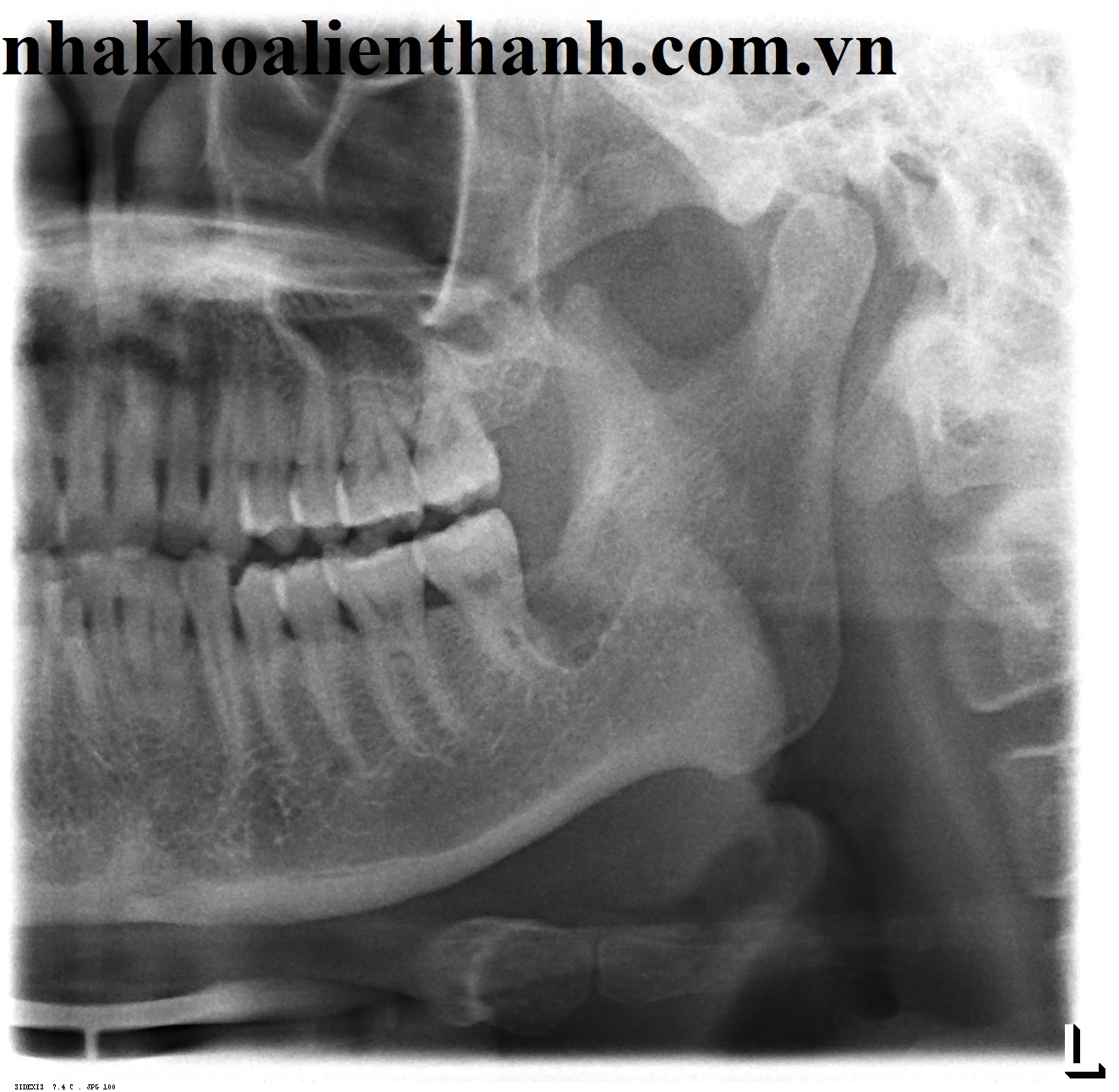 19222003_nguyen20minh20dac202