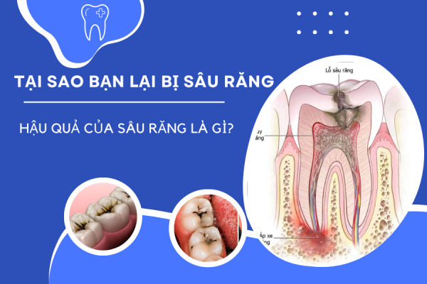 Dental Clinic Instagram Post (900 × 600 Px) (2)