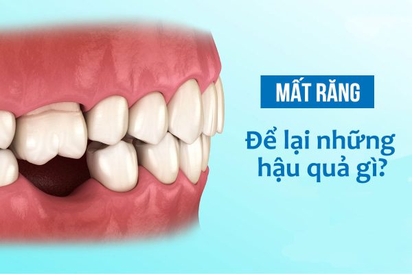 Hau Qua Mat Rang