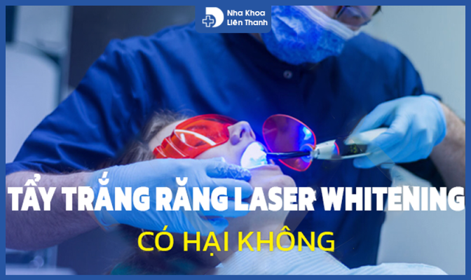 Vi Sao Nen Lua Chon Cong Nghe Tay Trang Rang Laser Whitening3