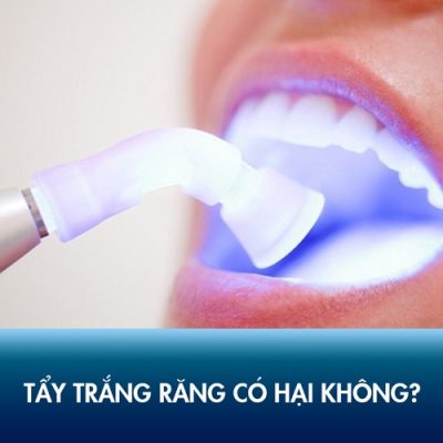 Tay Trang Rang